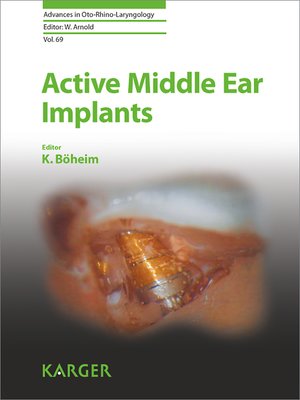 cover image of Active Middle Ear Implants